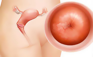 Tuyến tiền liệt